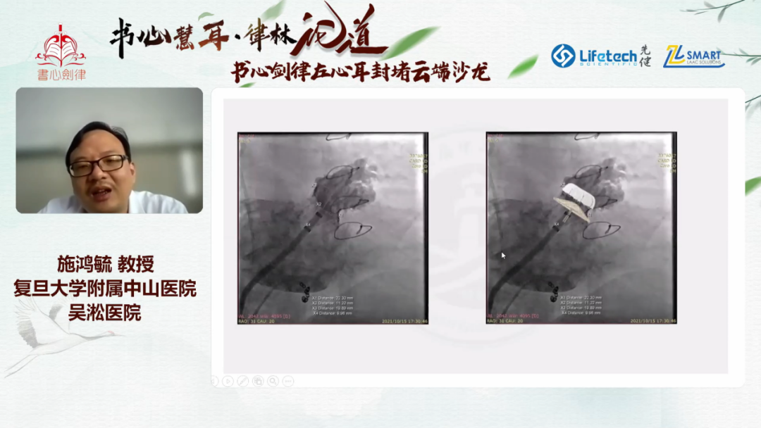 微信图片5.png 微信图片5.png