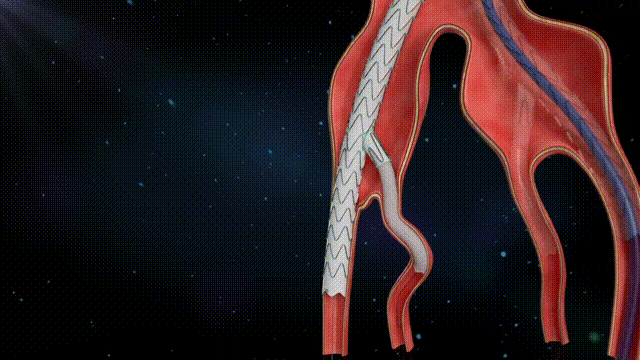 定稿.gif 定稿.gif