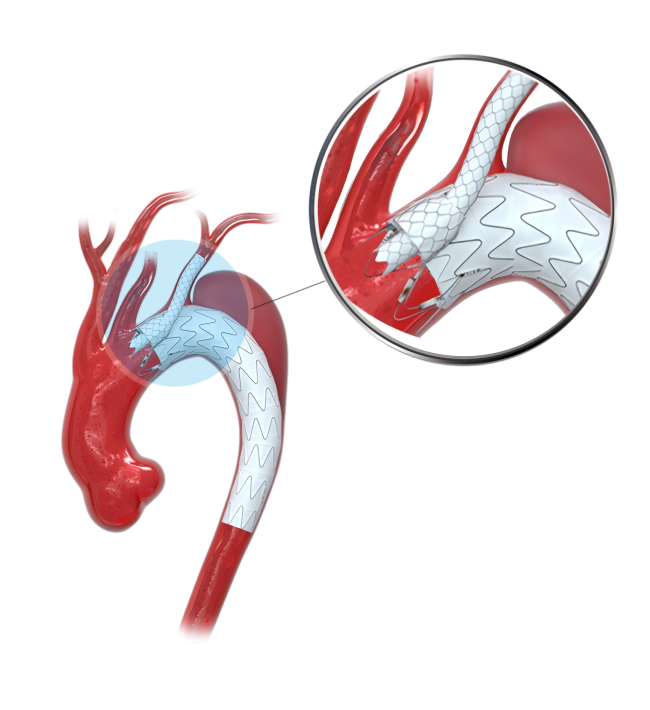 640(2).png 640(2).png